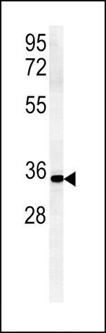 ANTI-ZDHC2 (N-TERMINAL) antibody produced in rabbit