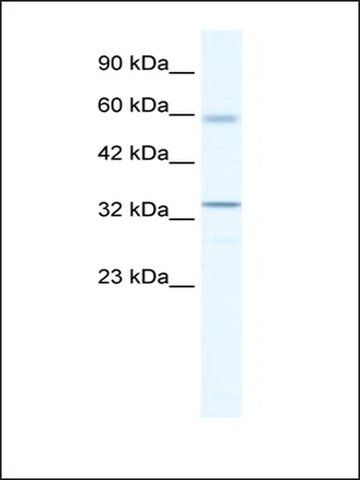 Anti-ZBTB7A (AB1) antibody produced in rabbit