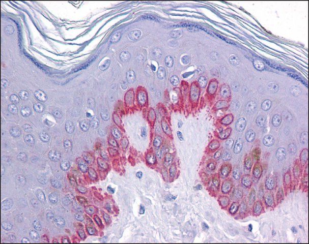 Anti-ZC3H12C antibody produced in rabbit