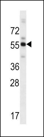 ANTI-ZBTB8B(C-TERMINAL) antibody produced in rabbit