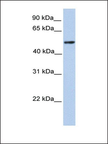 Anti-ZBTB9 (AB2) antibody produced in rabbit