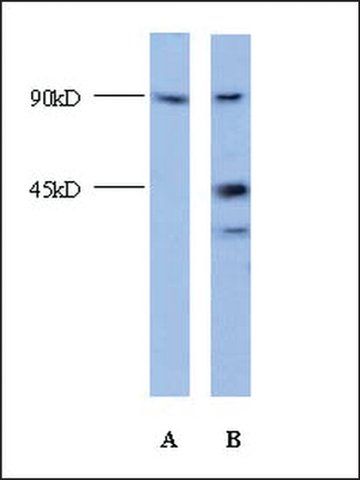 Anti-ZBTB6 (AB2) antibody produced in rabbit