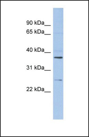 Anti-ZFAND6 antibody produced in rabbit