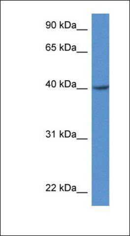 Anti-ZDHHC11 antibody produced in rabbit