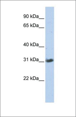 Anti-ZFAND3 (ab2) antibody produced in rabbit