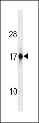 ANTI-ZFAND2A (CENTER) antibody produced in rabbit