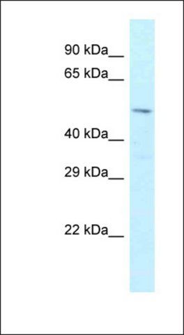 Anti-ZFP872 antibody produced in rabbit