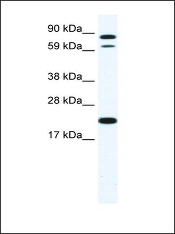 Anti-ZFP287 antibody produced in rabbit