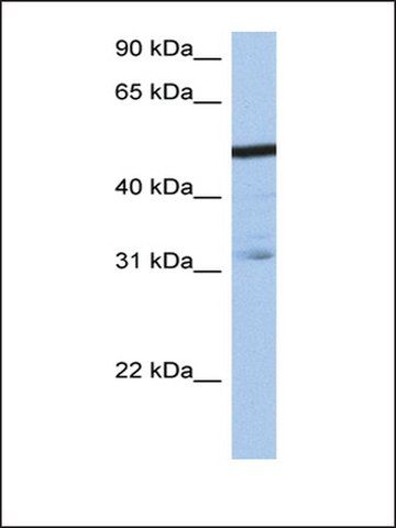 Anti-ZFP14 antibody produced in rabbit