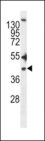 ANTI-ZDHHC20(N-TERMINAL) antibody produced in rabbit