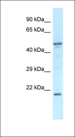 Anti-ZFP113 antibody produced in rabbit