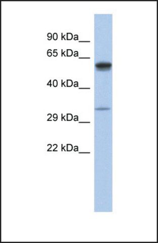 Anti-ZDHHC24 antibody produced in rabbit