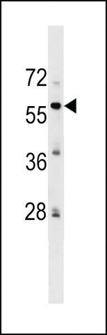 ANTI-ZFP82(N-TERMINAL) antibody produced in rabbit