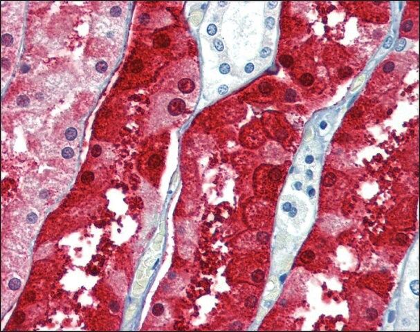 Anti-ZFYVE26 antibody produced in rabbit