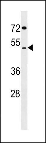 ANTI-SUDS3 (N-TERM) antibody produced in rabbit