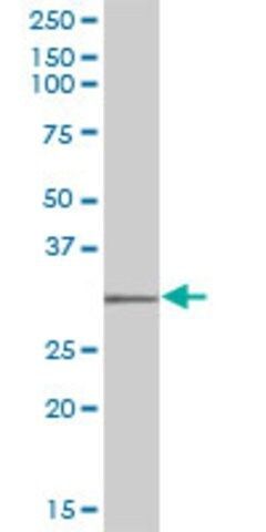 Anti-SULT1C2 antibody produced in mouse