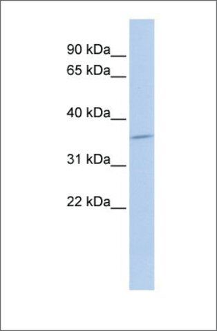 Anti-SULT1C4 antibody produced in rabbit