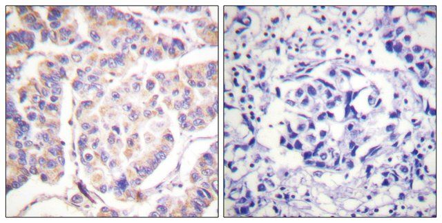 Anti-SYK, C-Terminal antibody produced in rabbit