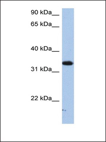 Anti-SULT6B1 antibody produced in rabbit