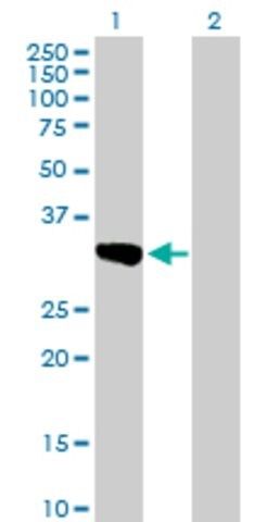 Anti-SULT1C1 antibody produced in mouse