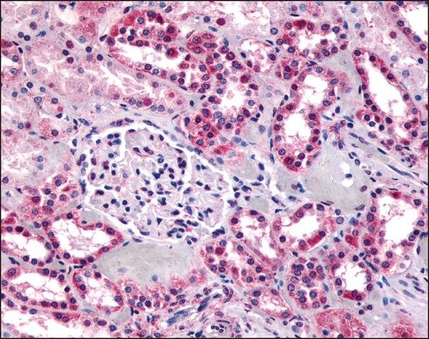 Anti-SUCNR1 antibody produced in rabbit