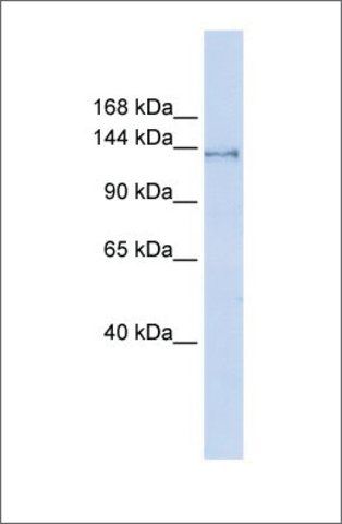 Anti-SUPT16H antibody produced in rabbit