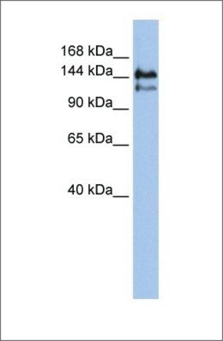 Anti-SUPT5H antibody produced in rabbit