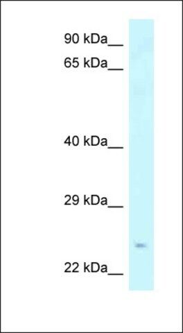 Anti-STXBP6 antibody produced in rabbit