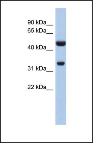 Anti-SULT1B1, (N-terminal) antibody produced in rabbit