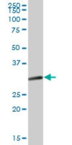 Anti-SULT1A1 antibody produced in mouse