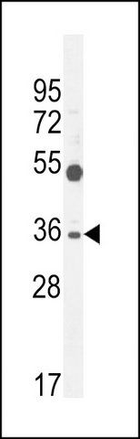 ANTI-SULT1C3 (C-TERM) antibody produced in rabbit