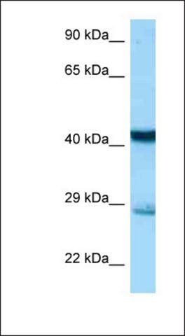 Anti-STX7 antibody produced in rabbit