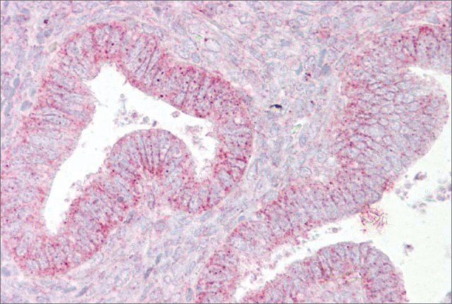 Anti-SUFU antibody produced in rabbit