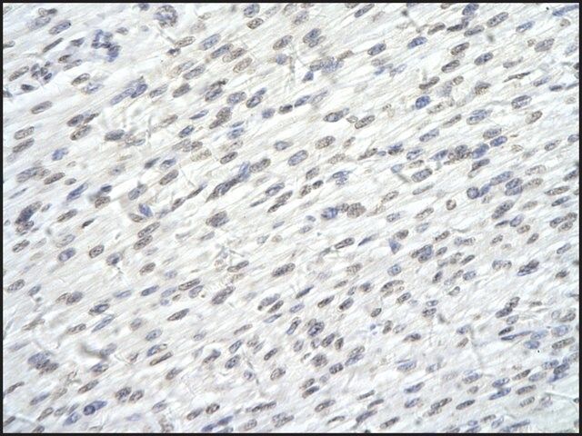 Anti-SUPT6H antibody produced in rabbit