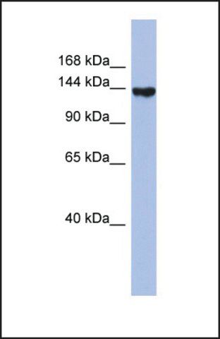 Anti-SYNJ2, (N-terminal) antibody produced in rabbit