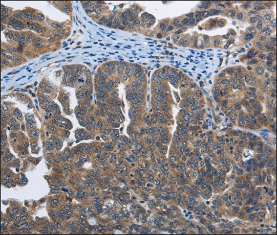 Anti-SYT3 antibody produced in rabbit