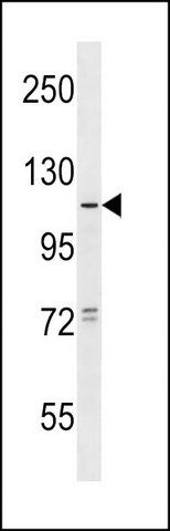 ANTI-TAS1R1 (CENTER) antibody produced in rabbit