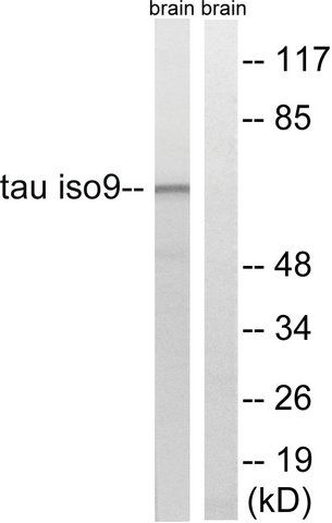 Anti-TAU antibody produced in rabbit