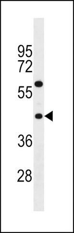 ANTI-TAS2R3(C-TERMINAL) antibody produced in rabbit