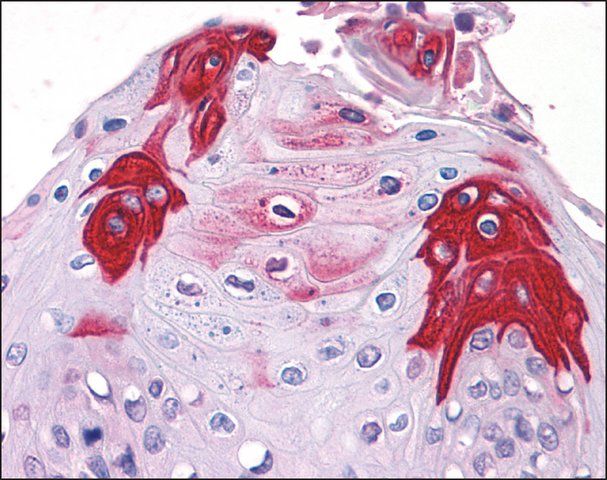 Anti-TAS1R3 antibody produced in rabbit