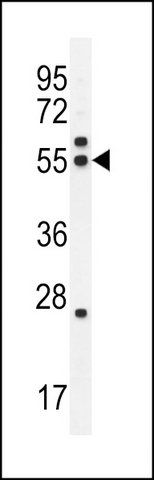 ANTI-TBB8B (C-TERM) antibody produced in rabbit