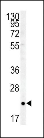 ANTI-TC10 (CENTER) antibody produced in rabbit