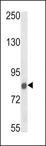 ANTI-TARSL2 (CENTER) antibody produced in rabbit