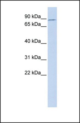 Anti-TBX2 antibody produced in rabbit