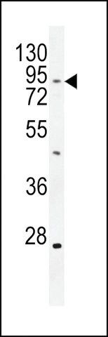 ANTI-TBC14 (CENTER) antibody produced in rabbit