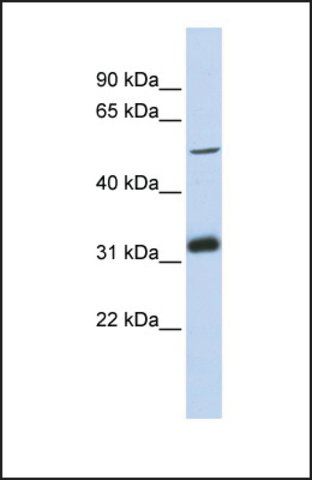 Anti-TC2N antibody produced in rabbit