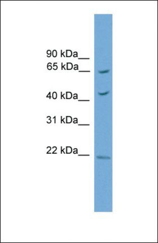 Anti-TBX18 antibody produced in rabbit