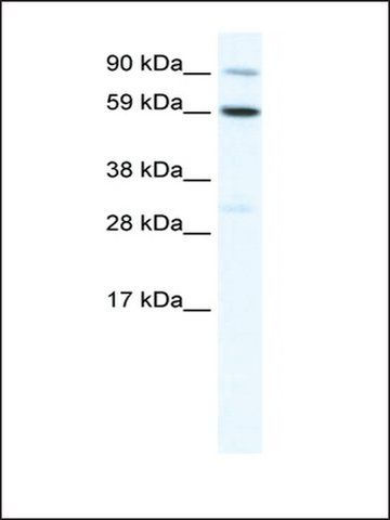 Anti-TBX21 (AB2) antibody produced in rabbit