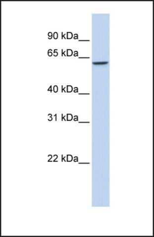 Anti-TBX22 antibody produced in rabbit