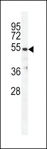 ANTI-TBB1(N-TERMINAL) antibody produced in rabbit